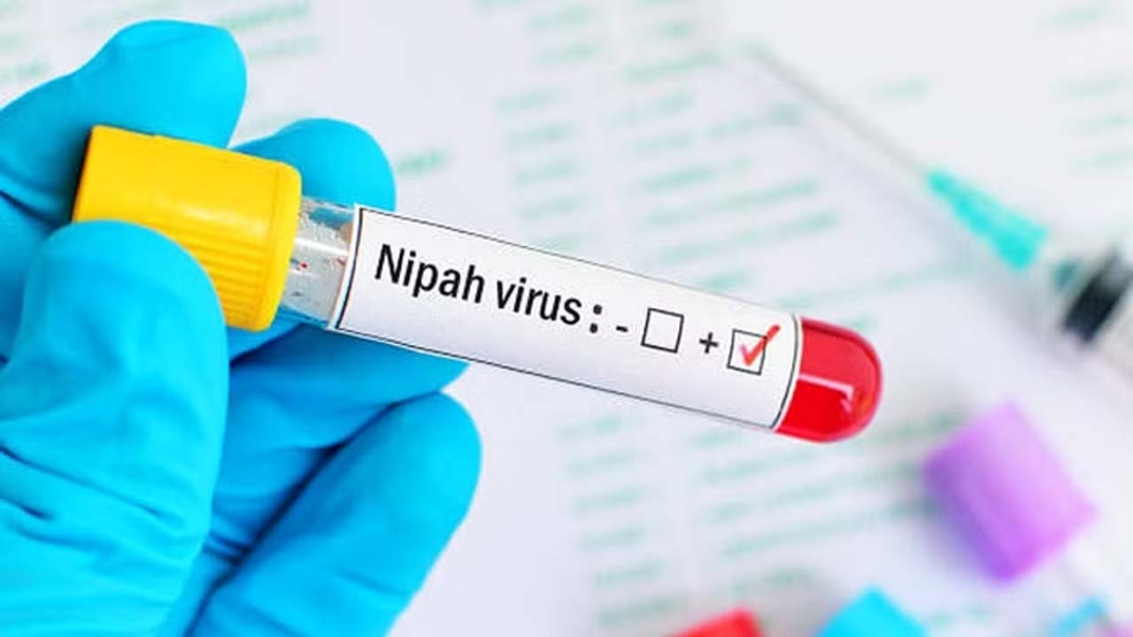 Nipah Virus