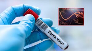 Ebola Suspected Cases: నగరంలో రెండు ఎబోలా కేసులు..