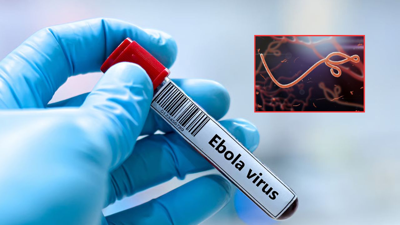 Ebola Suspected Cases