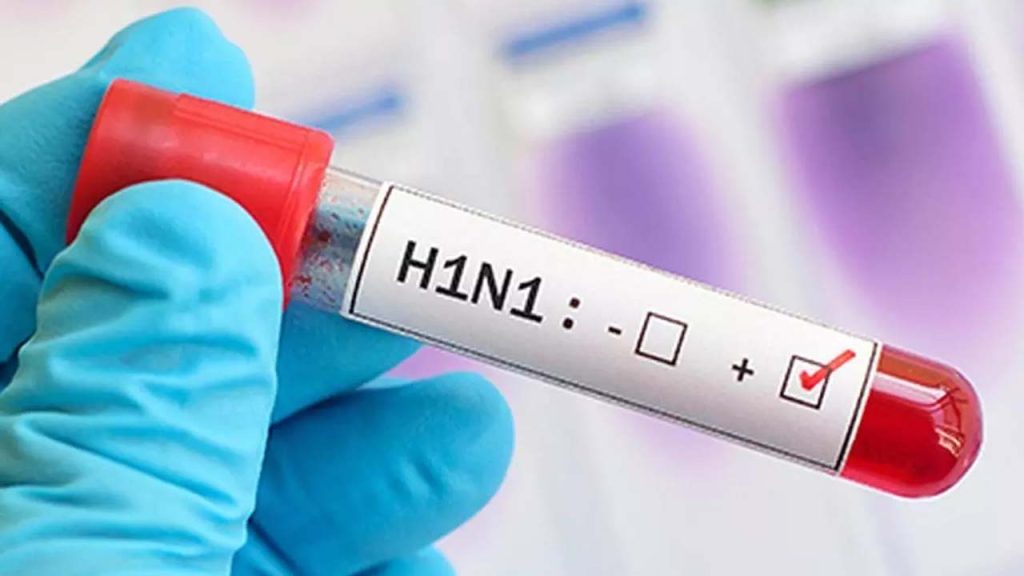 Delhi Swine Flu H1n1 Cases